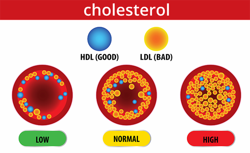 ăn hạt óc chó thường xuyên giúp cải thiện tình trạng bệnh mỡ máu, giảm cholesterol trong máu